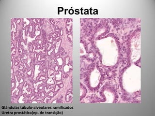 PróstataGlândulas túbulo-alveolares ramificadosUretra prostática(ep. de transição)
