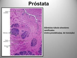 PróstataGlândulas túbulo-alveolaresramificadosUretra prostática(ep. de transição)