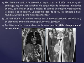  RM tiene un contraste excelente, espacial y resolución temporal; sin
embargo, hay muchas variables de adquisición de imágenes implicados
en MRI, que afectan en gran medida la calidad de imagen, visibilidad de
la lesión y de medición. La disponibilidad de la RM es variable a nivel
mundial. MRI del pecho no se recomienda "
 Las mediciones se pueden realizar en las reconstrucciones isotrópicos y
en planos no axiales de RM: sagital, coronal, (oblicuo).
 También aquí el punto clave es la consistencia. Mida siempre en el
mismo plano.
 