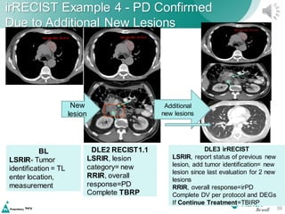 Recist Ecrf Cdisc Split RECIST irRECIST Imaging Criteria Training.pdf