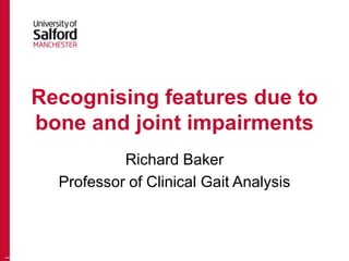 Recognising features due to
bone and joint impairments
Richard Baker
Professor of Clinical Gait Analysis
1
 