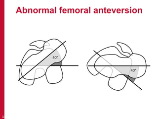 Recognising features (bone and joint deformity) | PPTX