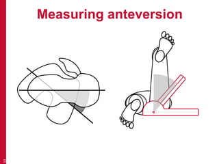 Recognising features (bone and joint deformity) | PPTX