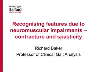 Recognising features due to
neuromuscular impairments –
contracture and spasticity
Richard Baker
Professor of Clinical Gait Analysis
1
 