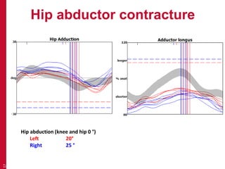 Hip abductor contracture
17
Hip abduction (knee and hip 0 °)
Left 20°
Right 25 °
 