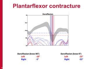 Plantarflexor contracture
21
Dorsiflexion (knee 90°)
Left -10°
Right -5°
Dorsiflexion (knee 0°)
Left -25°
Right -25°
 