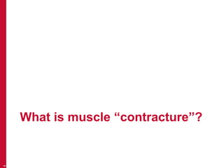 What is muscle “contracture”?
4
 