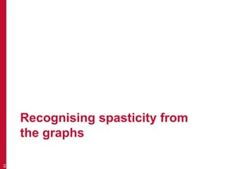 Recognising spasticity from
the graphs
43
 