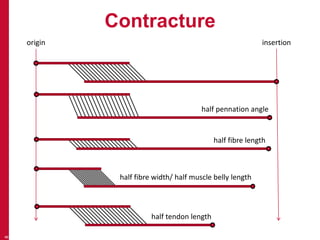 Contracture
8
origin insertion
half fibre length
half fibre width/ half muscle belly length
half tendon length
half pennation angle
 