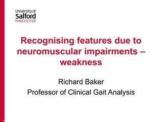 Recognising features due to
neuromuscular impairments –
weakness
Richard Baker
Professor of Clinical Gait Analysis
1
 