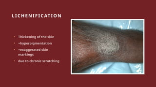 Exaggerated Skin Recognizing Skin Lesions, first step in diagnosis | PPTX