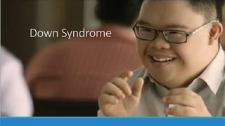 Down Syndrome
 