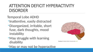 Temporal Lobe ADHD
◦Inattentive, easily distracted
◦Disorganized, irritable, short
fuse, dark thoughts, mood
instability
◦May struggle with learning
disability
◦May or may not be hyperactive
ATTENTION DEFICIT HYPERACTIVITY
DISORDER
This Photo by Unknown Author is licensed under CC BY
 