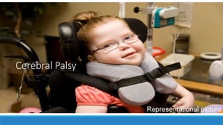 Cerebral Palsy
 