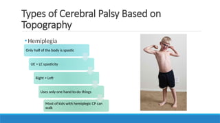 •Hemiplegia
Types of Cerebral Palsy Based on
Topography
Only half of the body is spastic
UE > LE spasticity
Right > Left
Uses only one hand to do things
Most of kids with hemiplegic CP can
walk
 