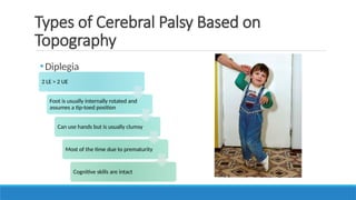 •Diplegia
Types of Cerebral Palsy Based on
Topography
2 LE > 2 UE
Foot is usually internally rotated and
assumes a tip-toed position
Can use hands but is usually clumsy
Most of the time due to prematurity
Cognitive skills are intact
 