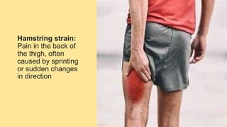 Recognizing sport injuries of upper and lower extremities.pptx