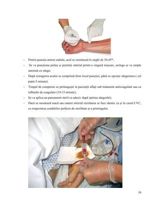 19
- Pentru puncția arterei radiale, acul se orientează în unghi de 30-45*;
- Se va puncționa pielea și peretele arterial printr-o singură mișcare, seringa se va umple
automat cu sânge;
- După extragerea acului se comprimă ferm locul puncției, până se oprește sângerarea ( cel
puțin 5 minute).
- Timpul de compresie se prelungește la pacienții aflați sub tratament anticoagulant sau cu
tulburări de coagulare (10-15 minute);
- Se va aplica un pansament steril cu adeziv după oprirea sângerării;
- Dacă se montează teacă sau cateter arterial recoltarea se face identic ca și în cazul CVC,
cu respectarea condițiilor perfecte de sterilitate și a primingului.
 