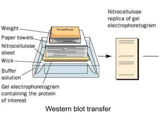 Western blot transfer
 