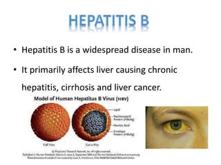 • Hepatitis B is a widespread disease in man.
• It primarily affects liver causing chronic
hepatitis, cirrhosis and liver cancer.
neethu asokan
 