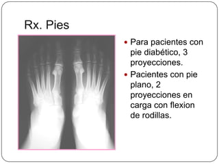 Pie Rx Awax Recomendaciones Px. Rx. | PPTX