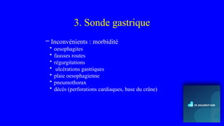 3. Sonde gastrique
– Inconvénients : morbidité
• oesophagites
• fausses routes
• régurgitations
• ulcérations gastriques
• plaie oesophagienne
• pneumothorax
• décès (perforations cardiaques, base du crâne)
 