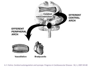 A. F. Folino. Cerebral autoregulation and syncope. Progress in Cardiovascular Disease : 50, 1, 2007:49-80
 