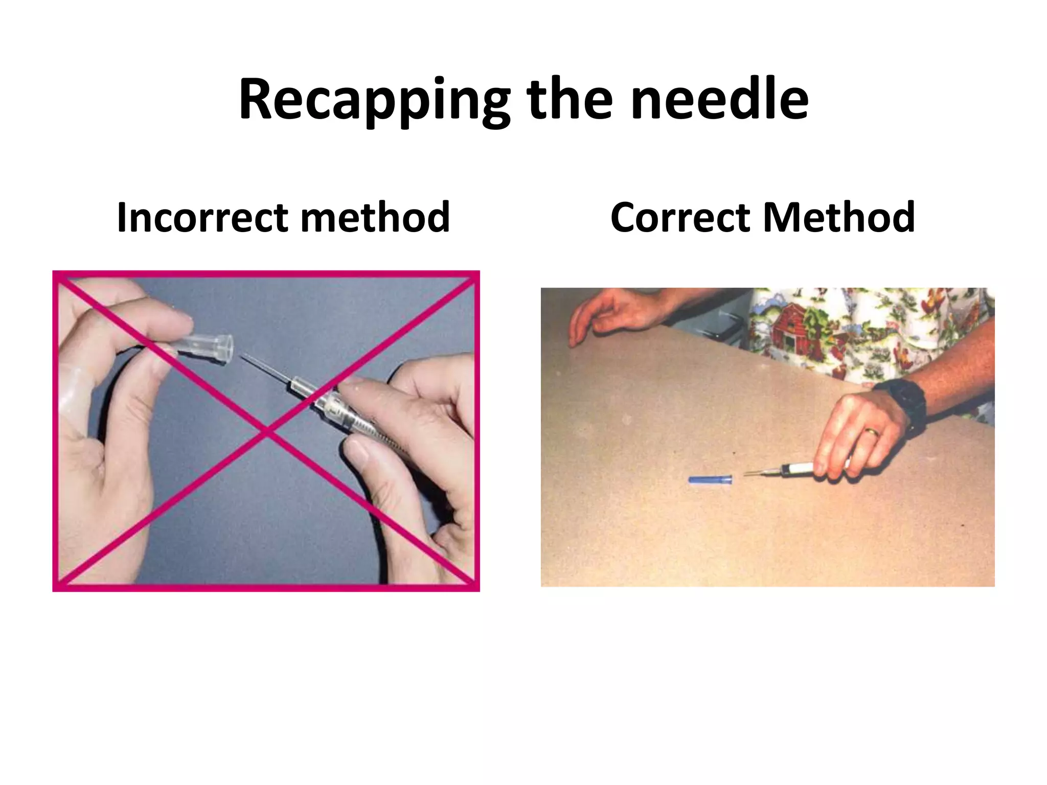 Recapping the needle
Incorrect method   Correct Method
 