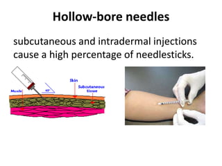 Hollow-bore needles
subcutaneous and intradermal injections
cause a high percentage of needlesticks.
 