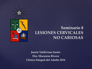 {
Seminario 8
LESIONES CERVICALES
NO CARIOSAS
Josefa Valdivieso Sastre
Dra. Macarena Rivera
Clínica Integral del Adulto 2014
 