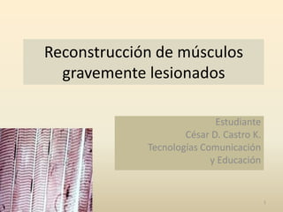 Reconstrucción de músculos
  gravemente lesionados

                            Estudiante
                     César D. Castro K.
             Tecnologías Comunicación
                           y Educación


                                          1
 
