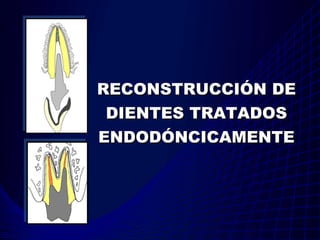 RECONSTRUCCIÓN DE
 DIENTES TRATADOS
ENDODÓNCICAMENTE
 
