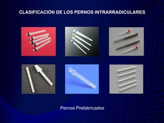CLASIFICACIÓN DE LOS PERNOS INTRARRADICULARES




              Pernos Prefabricados
 