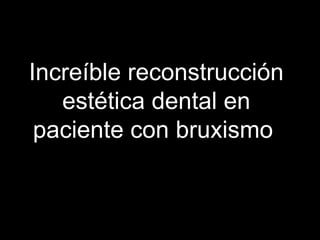 Increíble reconstrucción estética dental en paciente con bruxismo  www.clinicaelratoncitoperez.es 