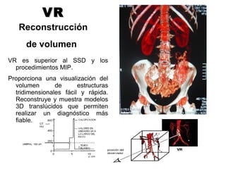 VRVR
Reconstrucción
de volumen
VR es superior al SSD y los
procedimientos MIP.
Proporciona una visualización del
volumen de estructuras
tridimensionales fácil y rápida.
Reconstruye y muestra modelos
3D translúcidos que permiten
realizar un diagnóstico más
fiable.
 