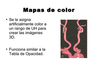 Mapas de colorMapas de color
●
Se le asigna
artificialmente color a
un rango de UH para
crear las imágenes
3D.
●
Funciona similar a la
Tabla de Opacidad.
 