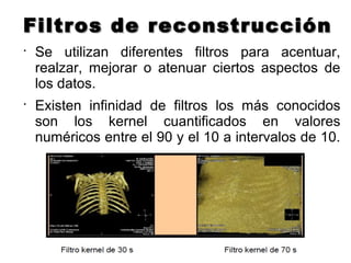 Filtros de reconstrucciónFiltros de reconstrucción
•
Se utilizan diferentes filtros para acentuar,
realzar, mejorar o atenuar ciertos aspectos de
los datos.
•
Existen infinidad de filtros los más conocidos
son los kernel cuantificados en valores
numéricos entre el 90 y el 10 a intervalos de 10.
 