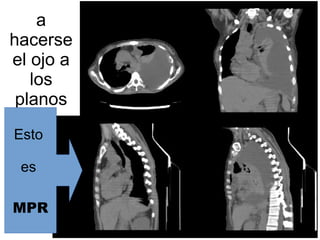 a
hacerse
el ojo a
los
planos
Fila 1 Fila 2 Fila 3 Fila 4
0
2
4
6
8
10
12
Columna 1
Columna 2
Columna 3
Esto
es
MPR
 