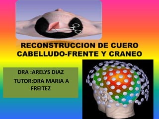 RECONSTRUCCION DE CUERO
CABELLUDO-FRENTE Y CRANEO
DRA :ARELYS DIAZ
TUTOR:DRA MARIA A
FREITEZ
 