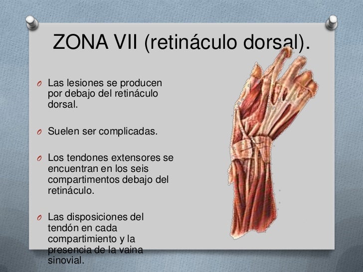 Extensores de la mano pdf creator