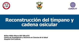 Núñez Millán Blanca RIV ORLyCCC
Centro de Investigación y Docencia en Ciencias de la Salud
Hospital Civil Culiacán
Reconstrucción del tímpano y
cadena osicular
 
