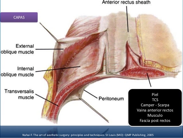 Reconstruccion De Pared Abdominal