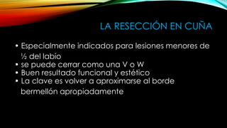 LA RESECCIÓN EN CUÑA
• Especialmente indicados para lesiones menores de
½ del labio
• se puede cerrar como una V o W
• Buen resultado funcional y estético
• La clave es volver a aproximarse al borde
bermellón apropiadamente

 