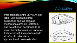 GOLDSTEIN
Para lesiones entre 25 y 50% del
labio, una de las mejores
soluciones son los colgajos
mucomusculares de Goldstein,
que se obtienen seccionando la
unión bermellón-cutánea en forma
tridimensional, incluyendo a todo
el músculo orbicular y
aprovechando su elasticidad

 