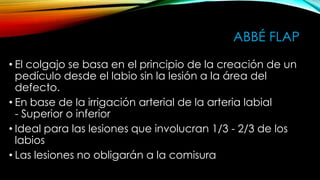 ABBÉ FLAP
• El colgajo se basa en el principio de la creación de un
pedículo desde el labio sin la lesión a la área del
defecto.
• En base de la irrigación arterial de la arteria labial
- Superior o inferior
• Ideal para las lesiones que involucran 1/3 - 2/3 de los
labios
• Las lesiones no obligarán a la comisura

 