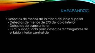 KARAPANDZIC
• Defectos de menos de la mitad de labio superior
- Defectos de menos de 2/3 de labio inferior
- Defectos de espesor total
- Es muy adecuada para defectos rectangulares de
el labio inferior central de

 