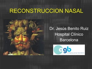 RECONSTRUCCION NASAL


          Dr. Jesús Benito Ruiz
             Hospital Clínico
                Barcelona
 