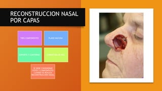 RECONSTRUCCION NASAL
POR CAPAS
TRES COMPONENTES PLANO MUCOSA
SOPORTE Y CONTORNO COBERTURA DE PIEL
SE DEBE CONSIDERAR
ESTOS 3 COMPONENTES
CUANDO SE REALIZA
RECONSTRUCCION NASAL
 