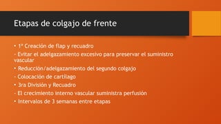 Etapas de colgajo de frente
• 1ª Creación de flap y recuadro
- Evitar el adelgazamiento excesivo para preservar el suministro
vascular
• Reducción/adelgazamiento del segundo colgajo
- Colocación de cartílago
• 3ra División y Recuadro
- El crecimiento interno vascular suministra perfusión
• Intervalos de 3 semanas entre etapas
 