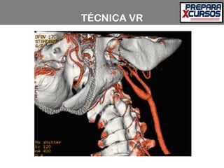 TÉCNICA VR
 